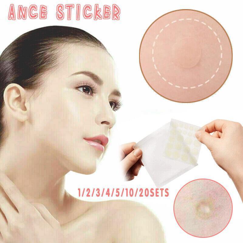 Acne Pimple Master Patch 24 Patches Blemish Control Genuine New Sealed