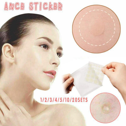 Acne Pimple Master Patch 24 Patches Blemish Control Genuine New Sealed